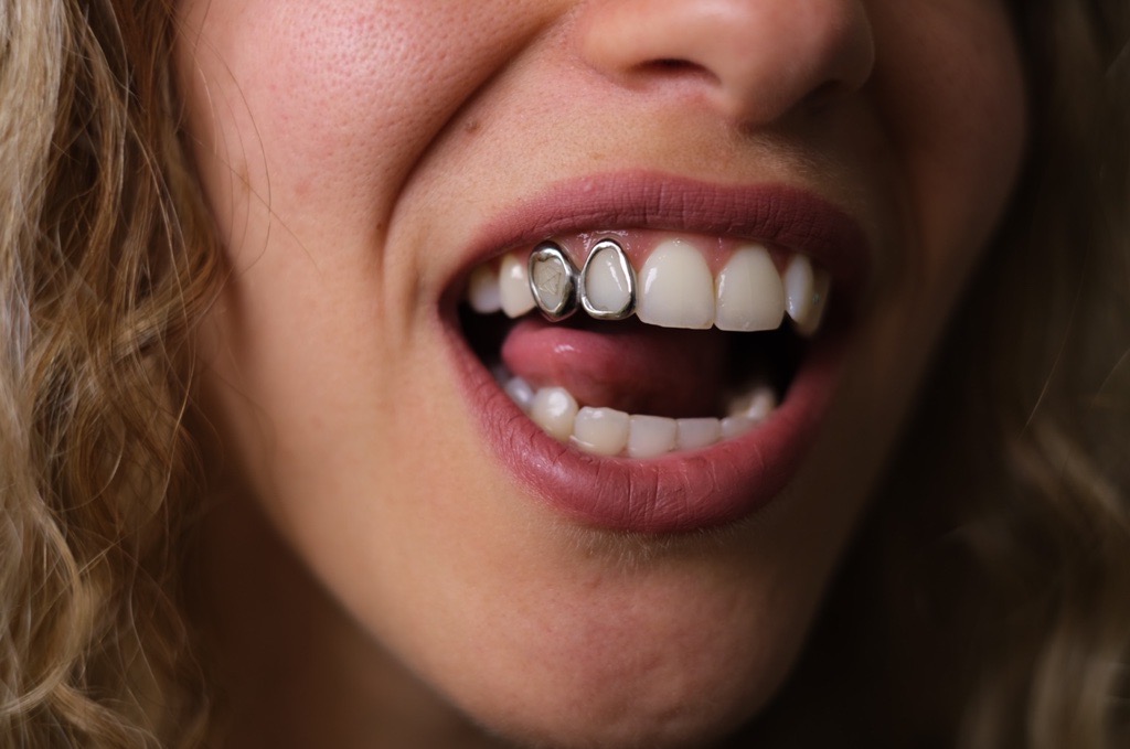 preguntas y respuestas sobre Grillz