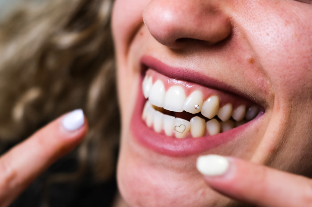 preguntas y respuestas sobre pegatinas para los dientes